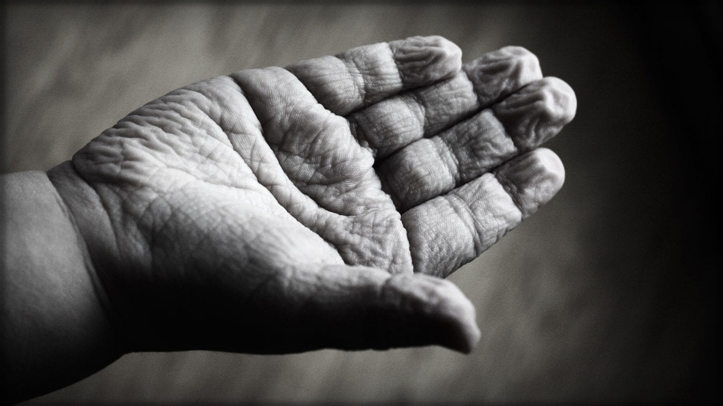 black and white photo of a wrinkled hand