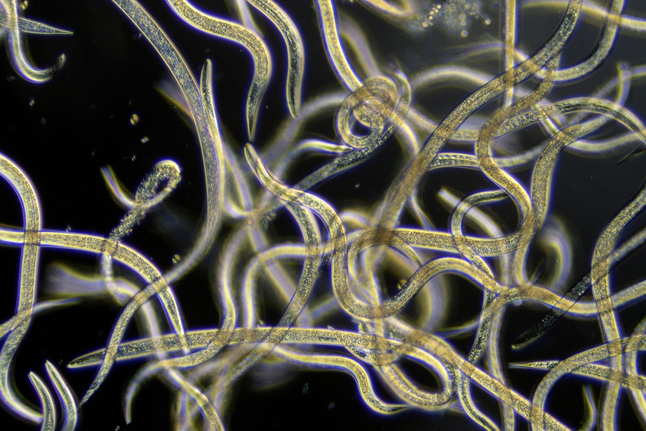 microscopic view of transparent yellow worms with a black background curving around the image