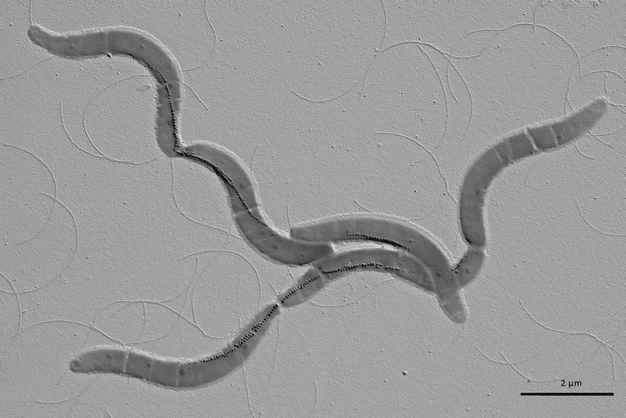 black and white microscopic image of bacteria