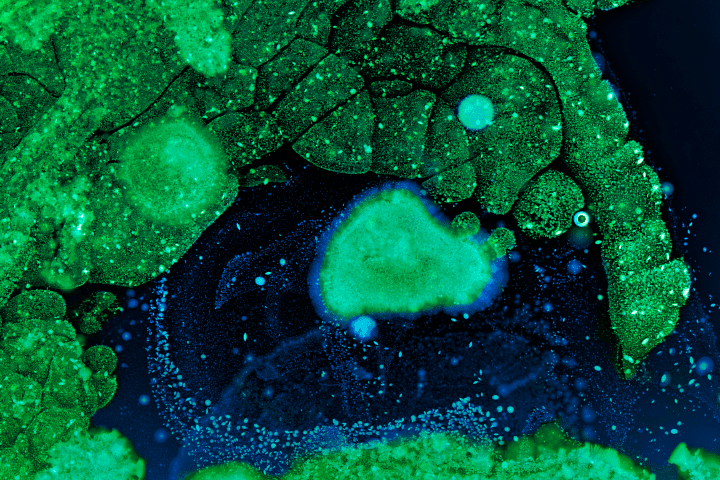 green and blue bacteria colonies and molds in a petri dish